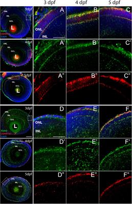 Proteasome-Mediated Regulation of Cdhr1a by <mark class="highlighted">Siah1</mark> Modulates Photoreceptor Development and Survival in Zebrafish